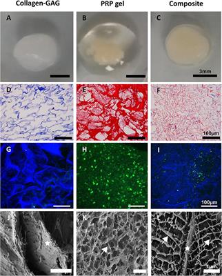 Functionalising Collagen-Based Scaffolds With Platelet-Rich Plasma for Enhanced Skin Wound Healing Potential